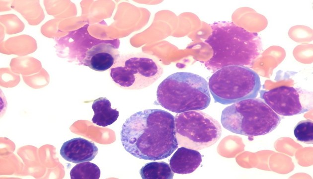 Blood Smear