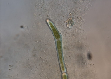 algae