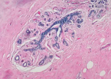Pathology Imaging